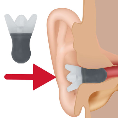 Pressure Reducing Ear Plugs with Storage Case